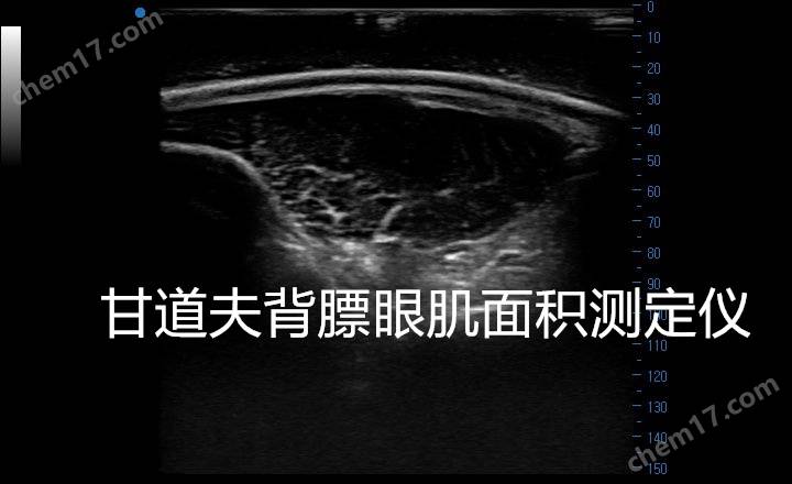 背膘眼肌面积测定仪超声影像(3)兽用b超眼肌测定仪检测怀孕母猪背膘