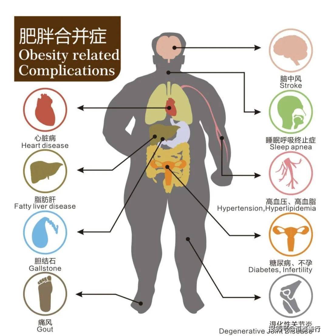 肥胖治疗新方向,肠菌移植帮你忙!_肠道_影响_超重