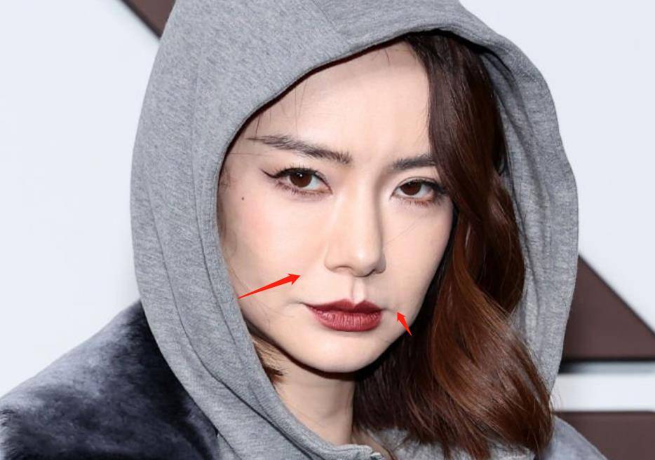 表情的时候,法令纹非常明显,嘴部肌肉变得有些奇怪,脸看起来有些凹陷