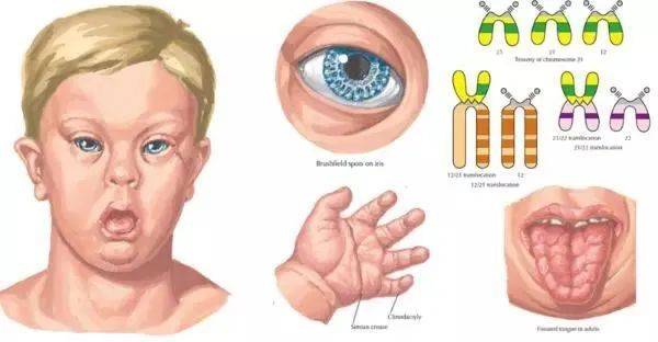 误区不可信_综合征_患者_真相