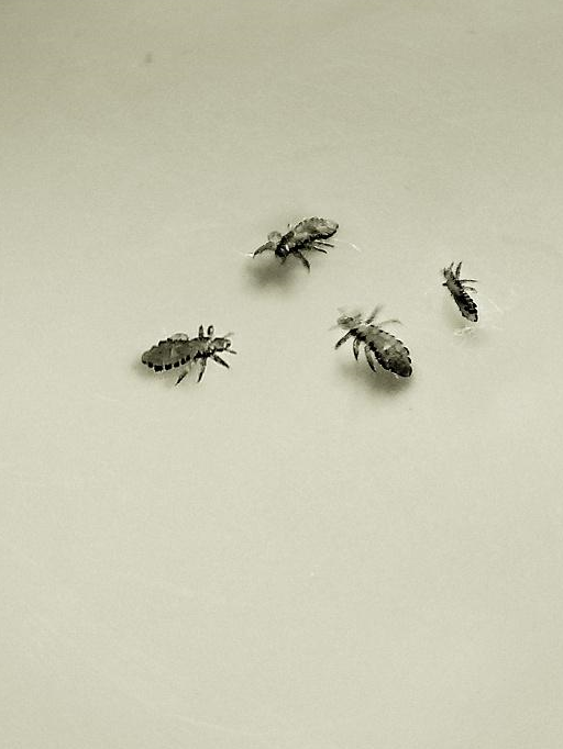 阴虱只"喜欢"女性?阴虱的3种传播途径,如果感染时,做好3点!