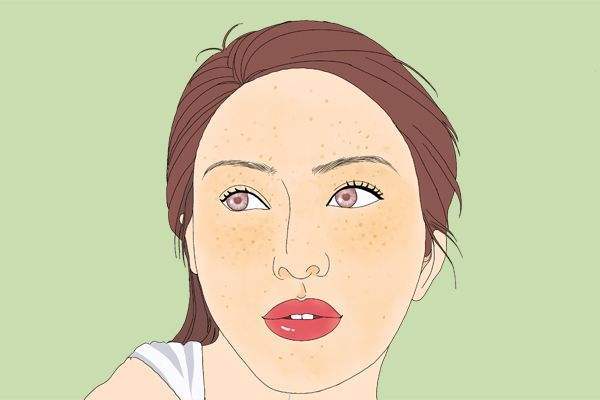 祛斑护肤品排行榜前十名,淡斑效果好的护肤品_肌肤_套装_产品