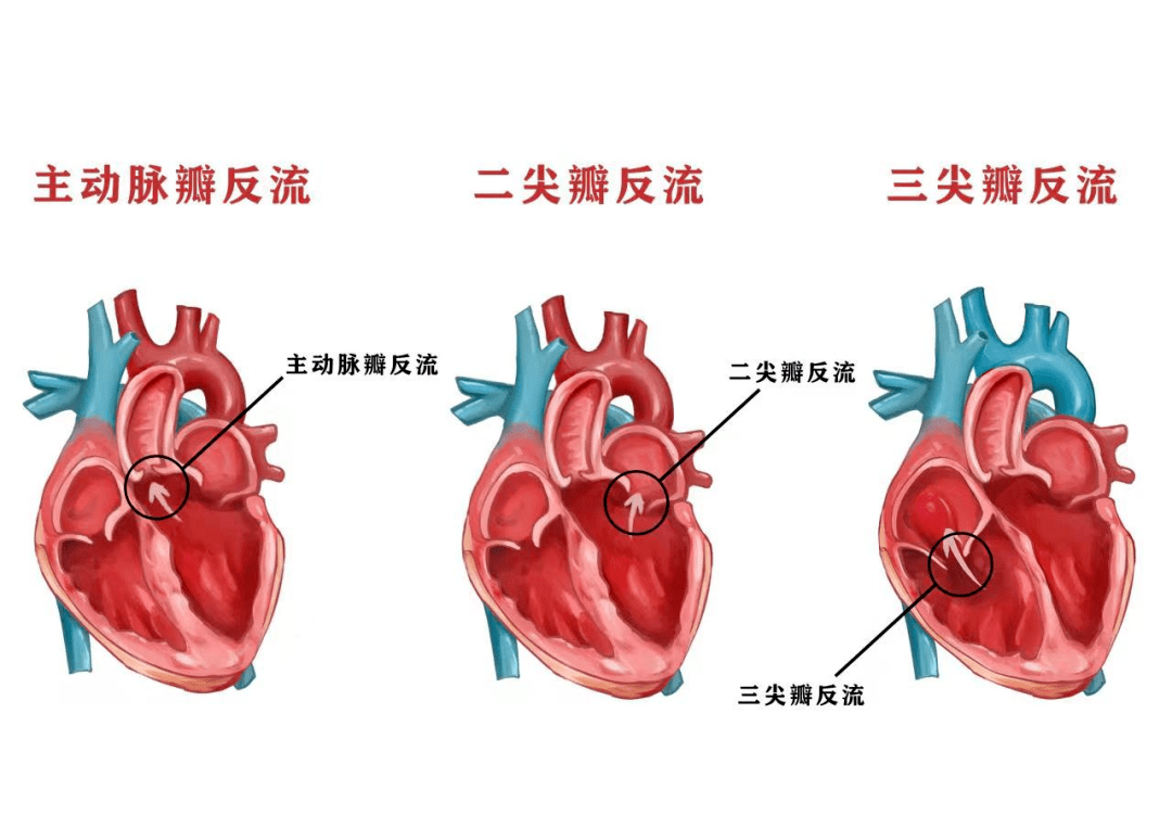 二尖瓣位置图片