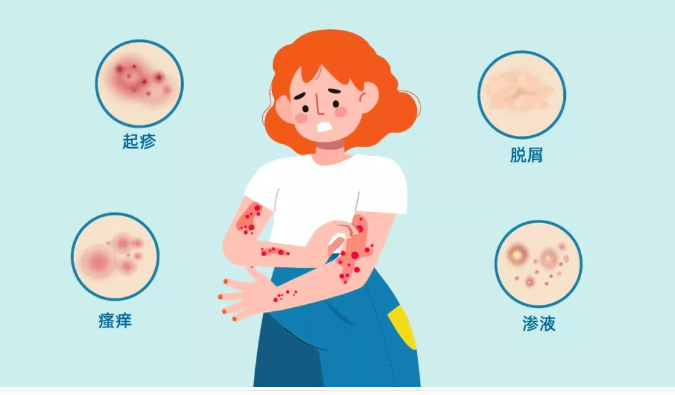 皮肤_局部_严重