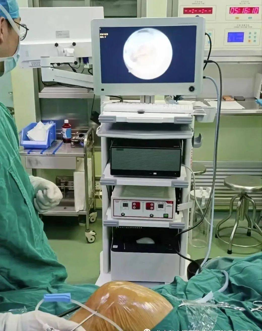 微创针刀镜——中西医结合的时代产物_操作_进行_组织
