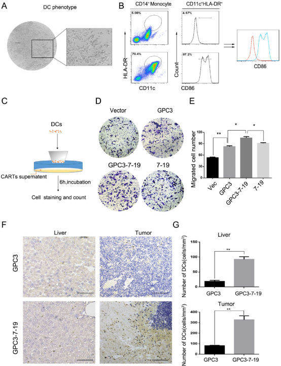 原代hcc类器官共培养技术,揭示gpc3-7-19-car-t