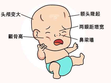 认识疾病|"地中海"贫血不是在说发型啦!_诊断_基因_重型