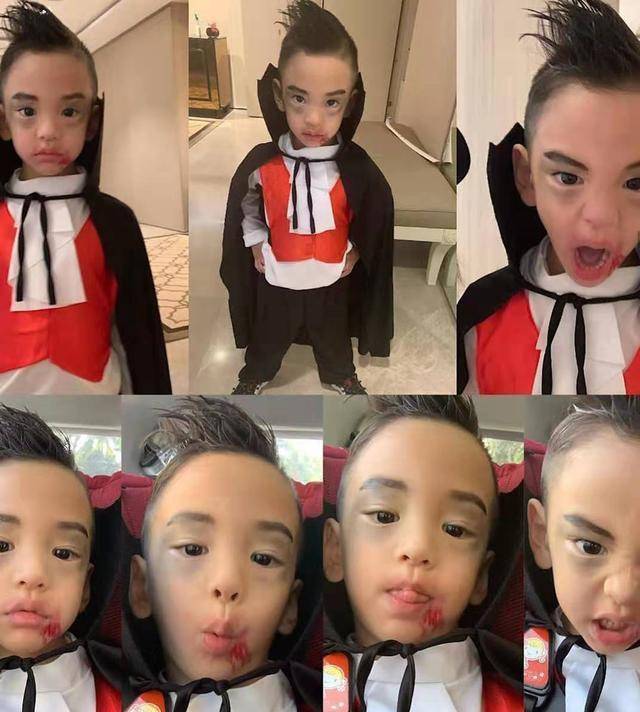 女神徐若瑄嫁入豪门晒照鼻青脸肿,和儿子脸上血迹斑斑,原因搞笑_化妆