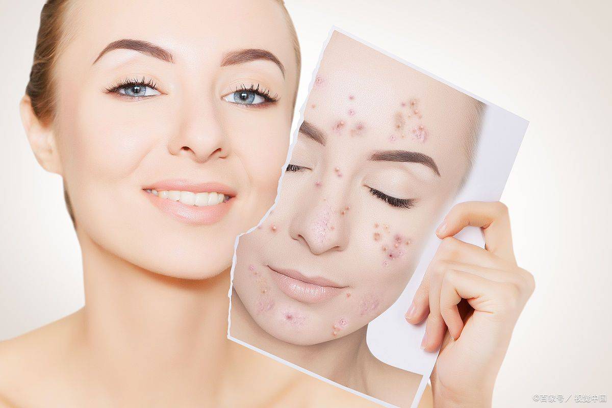 祛斑技师证书考试好通过吗?67岗位职责?_进行_考生_相关