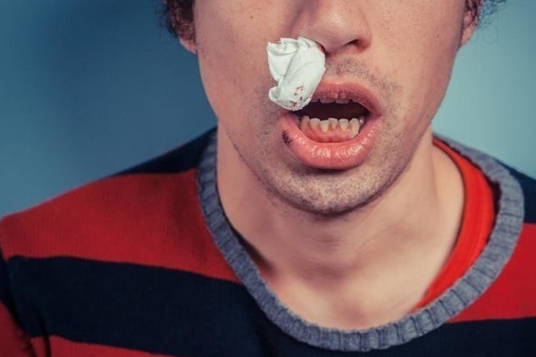 50%有车族患过敏性鼻炎，医生：学会洗bizi，一招制敌_鼻子_方法_鼻腔