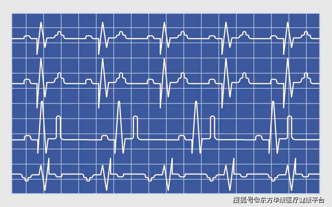 心电图报告单书写图片