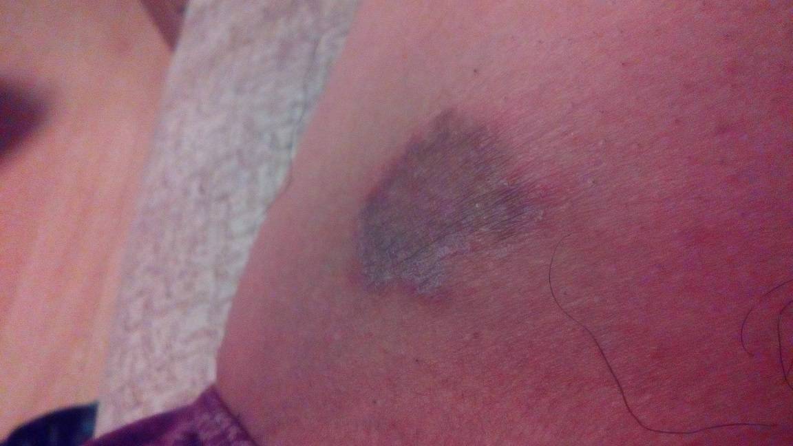 黑色大腿内侧的秘密揭晓!你知道吗?