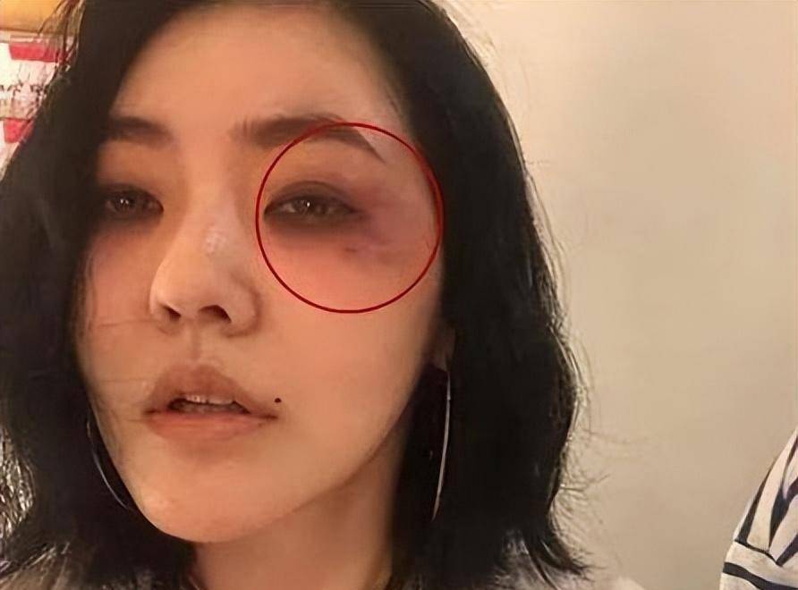 小s的伤在我眼角余光里,但我还是懂得用墨镜遮掩,否认家庭丑闻.