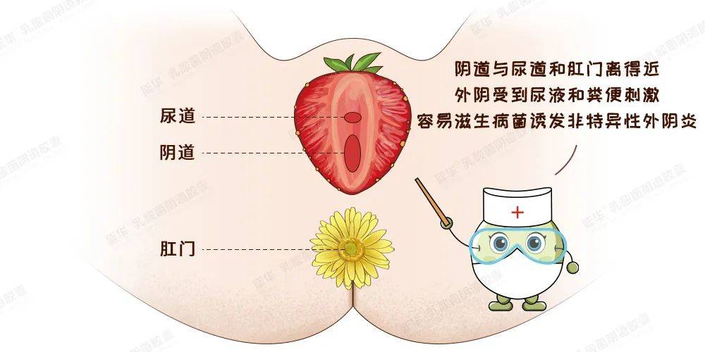 私处瘙痒难耐白带报告却查不出明确病因?你可能招惹上它了