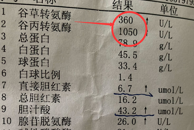 转氨酶90严重吗 来自搜狐网