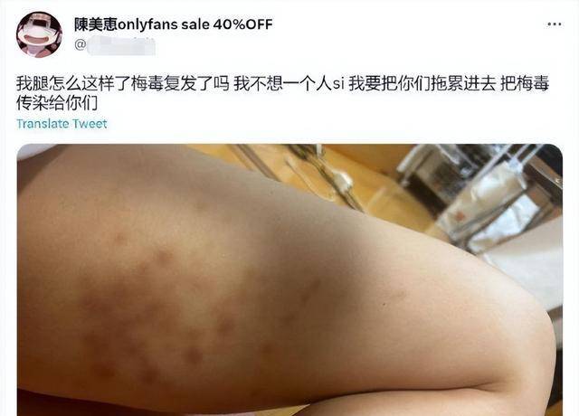 东北味爱情电影的她,如今身患梅毒无片可演,凄惨下场闻人落泪_陈美惠