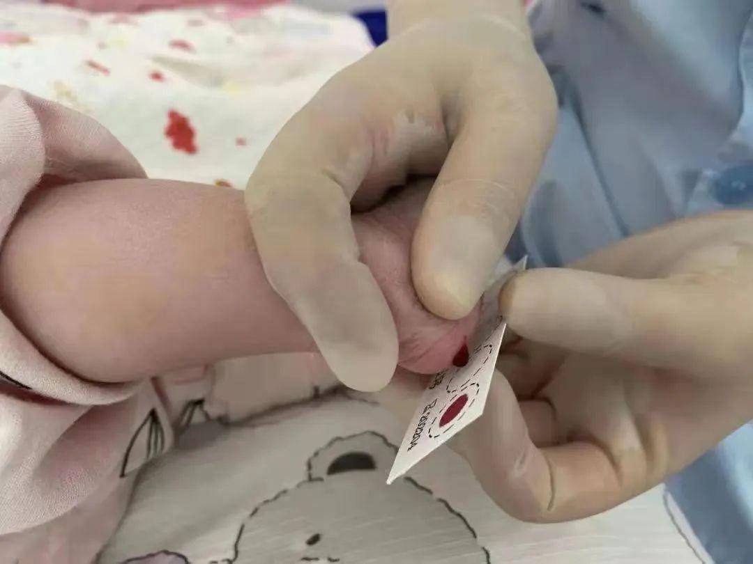 新生儿足底采血图片