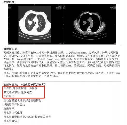 廣州美年專業體檢指導,幫助71歲老人