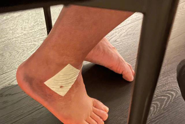 陈赫手术后7天不能走路,邓超鹿晗去探望,三人晒合影隔空互怼好欢乐