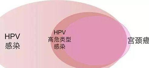 及早治疗,免疫力至关重要对抗hpv感染,及早治疗是关键.
