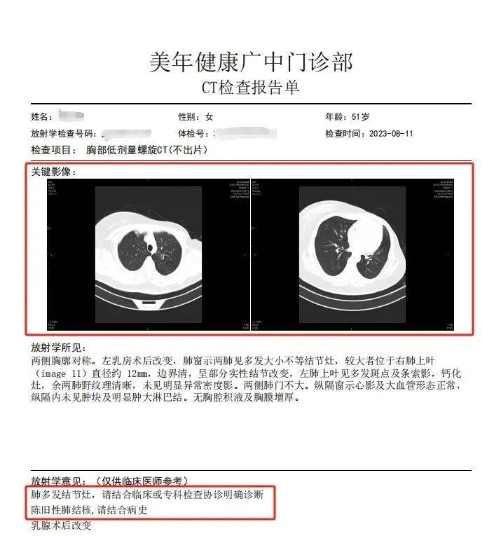 肾癌检查报告图片