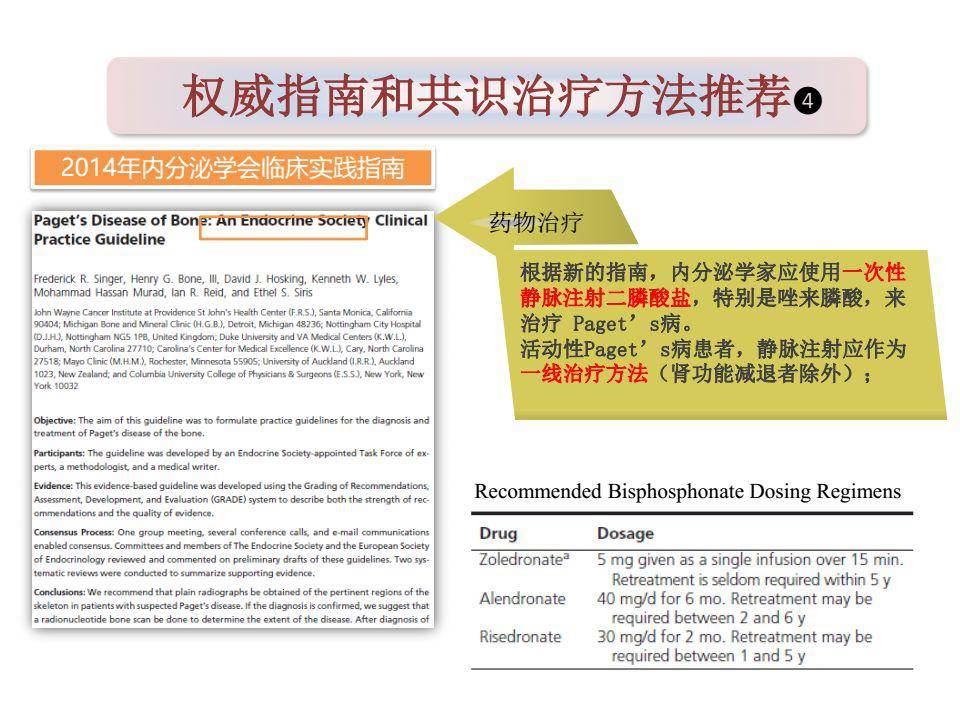 一文搞定paget骨病诊治详解
