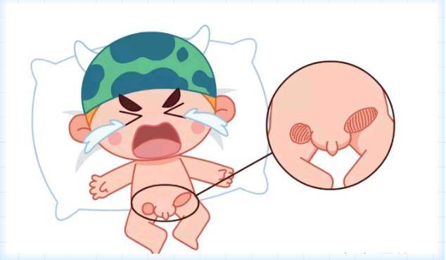 男宝宝疝气症状图片图片