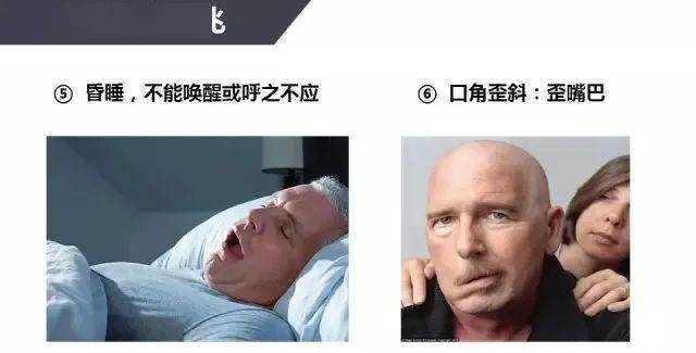 預防中風每個人都要知道的知識點