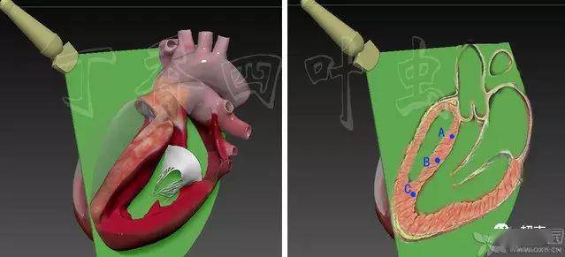 3d圖解心臟解剖與心臟超聲切面