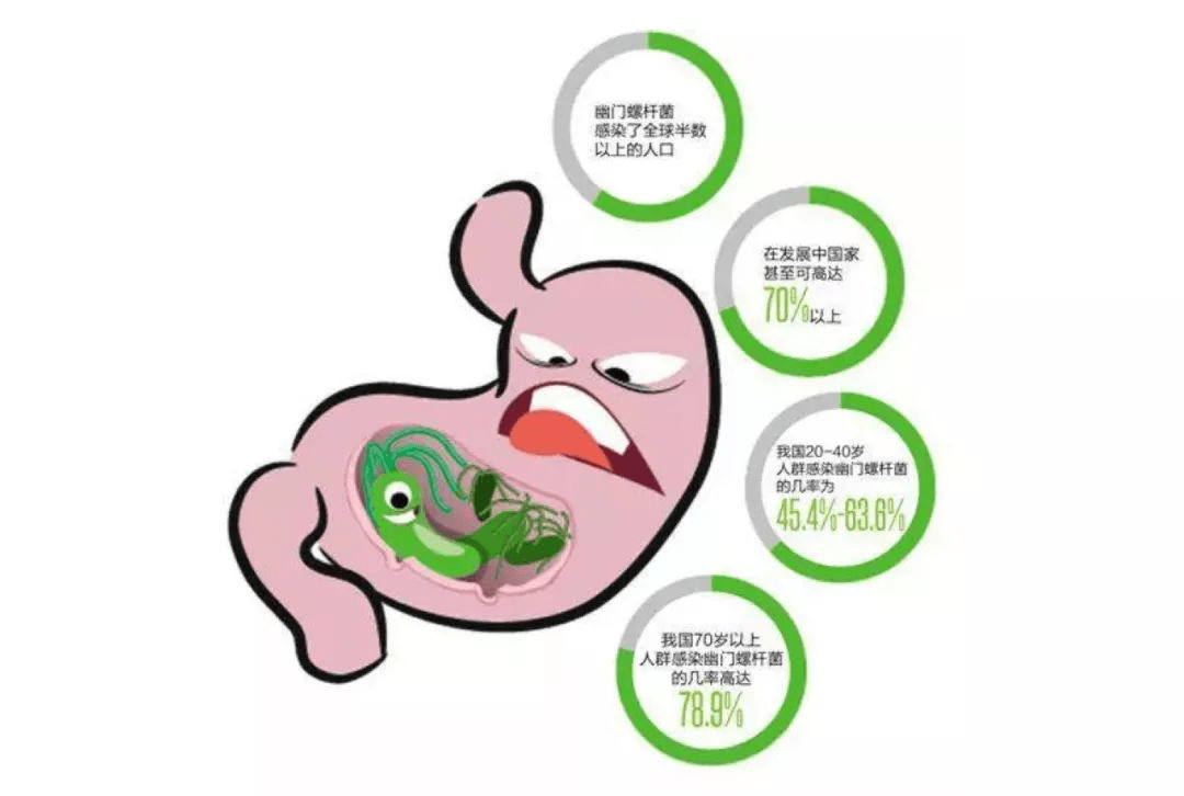 檢測出幽門螺桿菌,到底治不治?