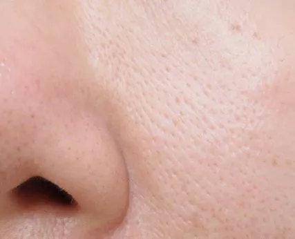 adsc小红瓶细腻毛孔打造柔润肌肤