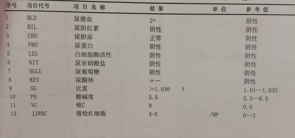 收藏了!原来你的尿检报告是这么来的