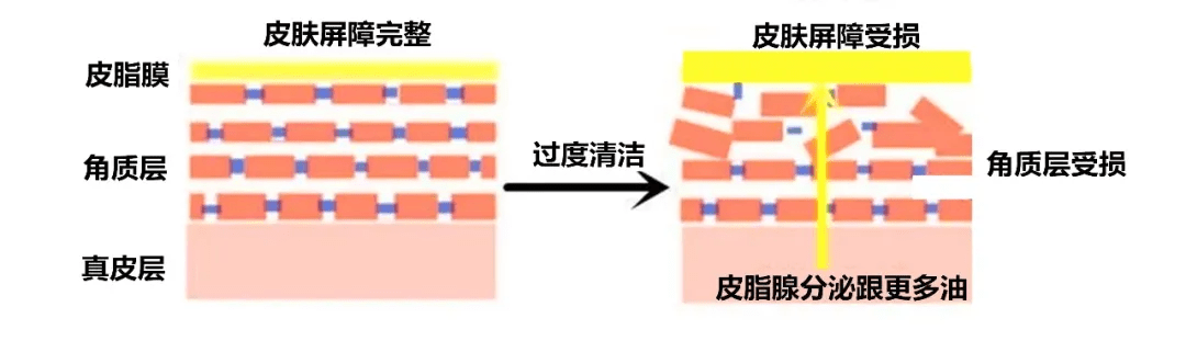 因为|皮肤油因为缺水,你信吗？我信