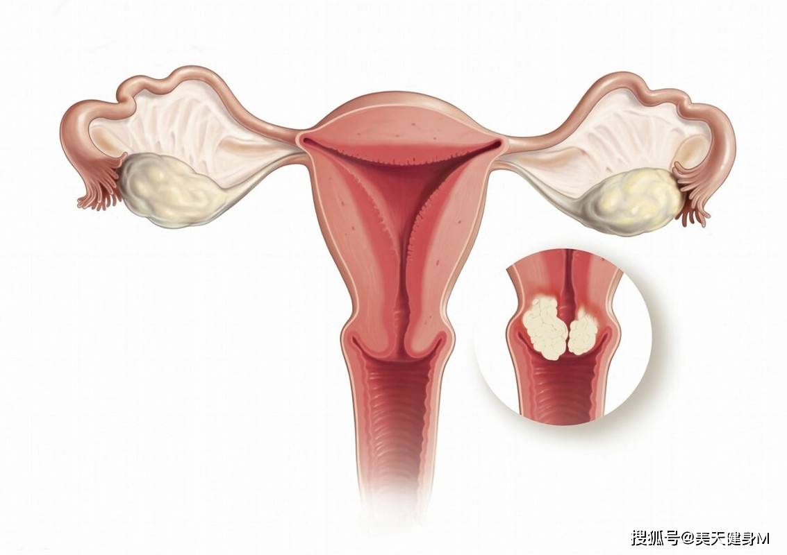 女性生理期到底能運動嗎？應該如何運動？一文告訴你 健身減肥達人 第3张