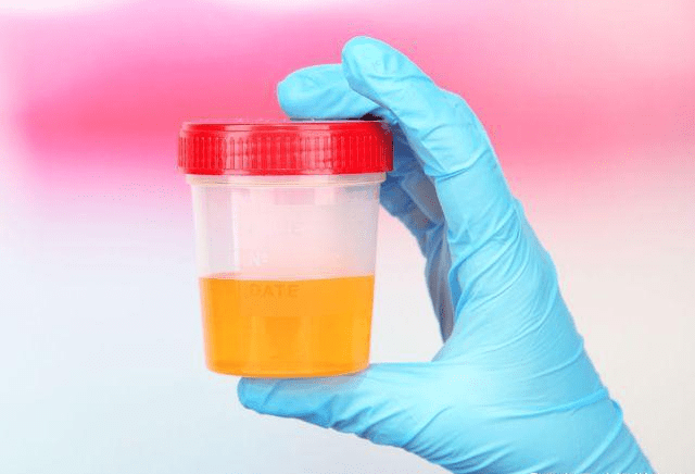 汗孔|若这3个部位经常“发臭”，或许是肝脏在向你“求救”，莫忽视