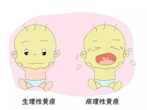 婴儿怎么晒黄疸正确 780160f1f517482b9c679182aa645de9.png