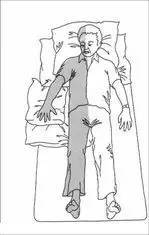 上肢|偏瘫患者的日常康复训练手法图解