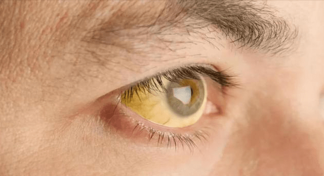 红灯|身体有这“3个”异常,是肝脏闪“红灯”了,,恭喜你肝还不错