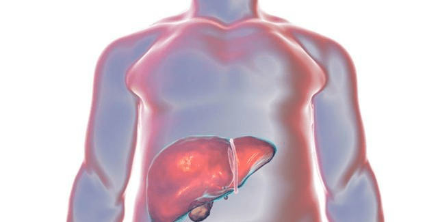肝脏|身体出现“1大1黄1痒”，提醒你注意：或是肝脏的“求救”信号