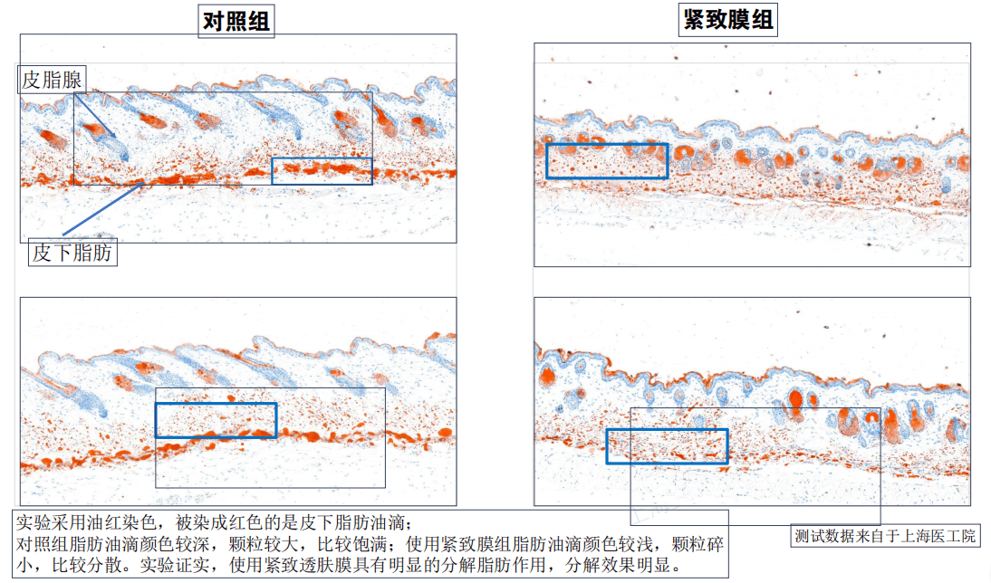 对比|不二生物科技：填补国内面膜市场技术空白