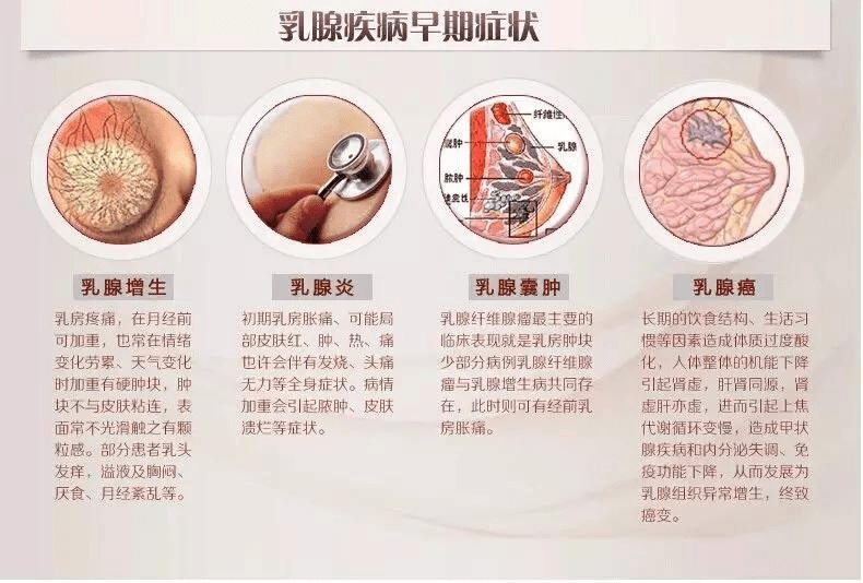乳腺疾病的发展过程图图片