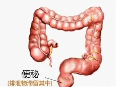 18ad659536ca4c1081742b2d61237861.png