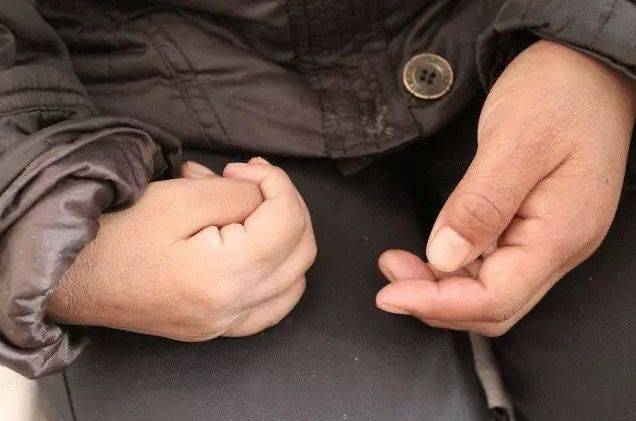 如何改善偏瘫后痉挛的问题这4方面是关键