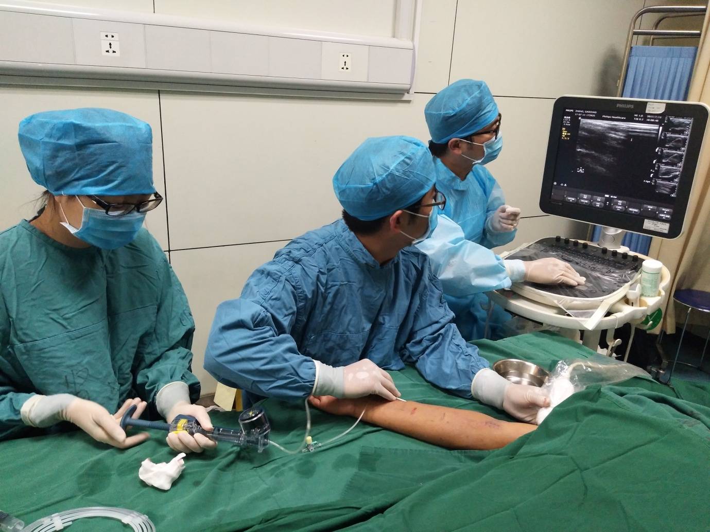 覆膜|肾脏内科实施陕西省首例超声引导下透析通路支架植入术