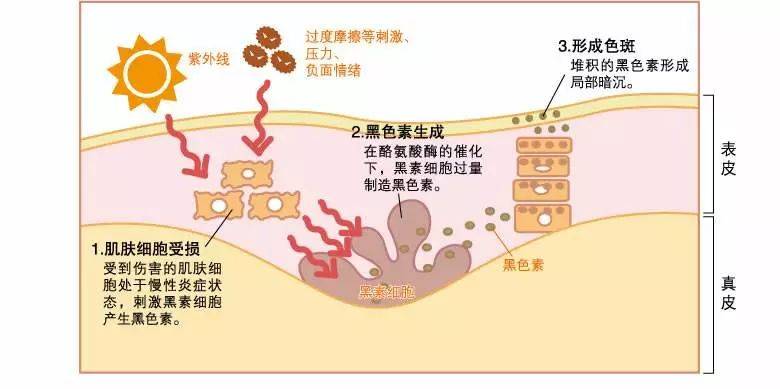 侵袭|真的有晒不黑的人么？