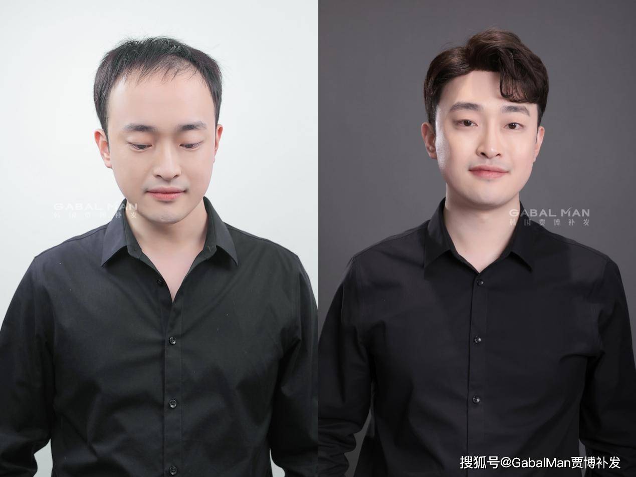 假发想不到戴假发有这么多好处,超适合脱发人,get到了