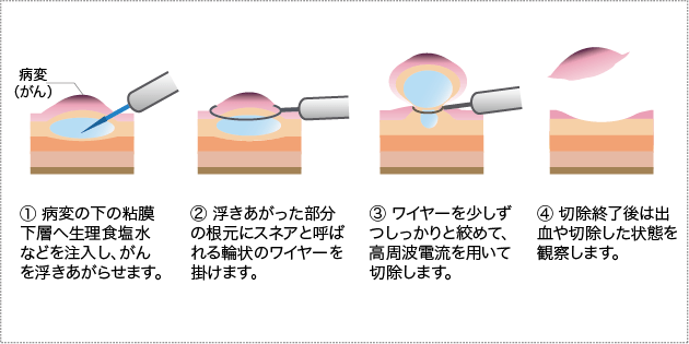 b171ffc9c57a4f67a05a68dddafd806a.png