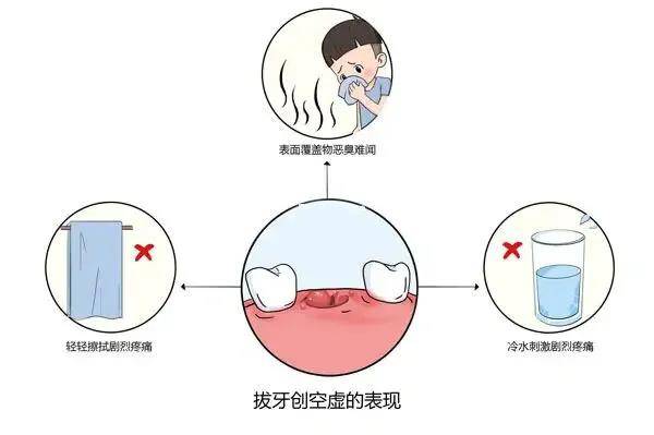 拔牙後傷口越來越疼小心是它在搗亂