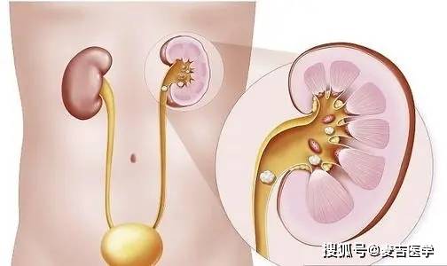 什么|世界上最疼的病，你知道是什么吗？经历过的都是“超人”