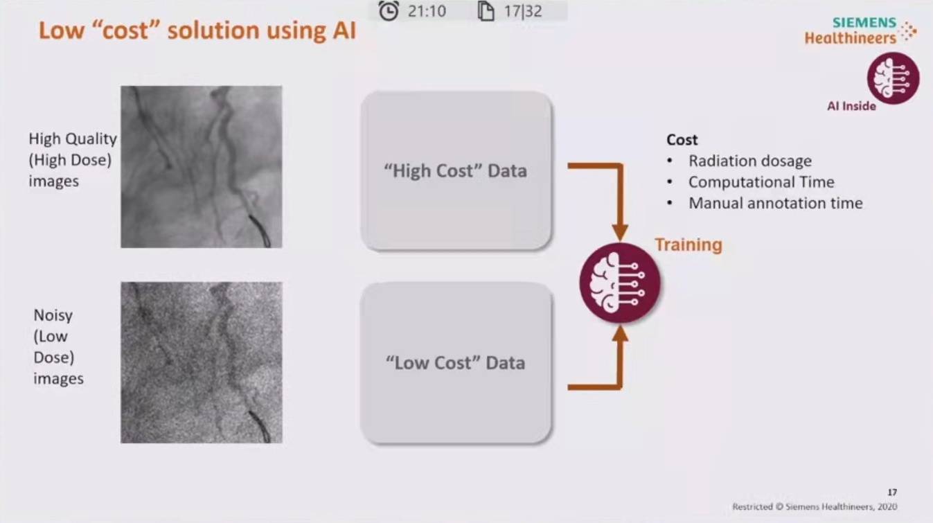 降低|神经介入领域新技术展望